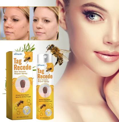 Tag Recede Eliminador de verrugas